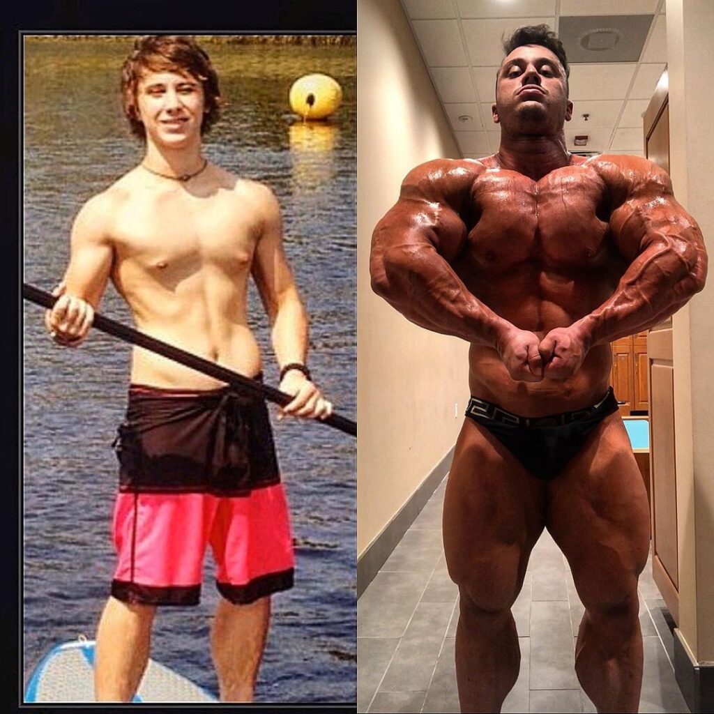 Elliott Dermond before and after