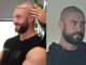 hair transplant in bodybuilding